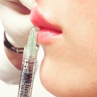 Vollere Lippen Tipps Fur Einen Tollen Look Ohne Operation Schonheitsklinik Praxis Dr Yusuf Yildirim Aesthetics